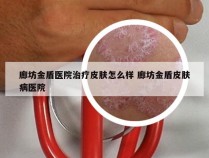 廊坊金盾医院治疗皮肤怎么样 廊坊金盾皮肤病医院