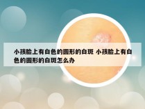 小孩脸上有白色的圆形的白斑 小孩脸上有白色的圆形的白斑怎么办