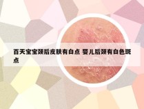 百天宝宝颈后皮肤有白点 婴儿后颈有白色斑点