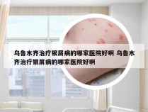 乌鲁木齐治疗银屑病的哪家医院好啊 乌鲁木齐治疗银屑病的哪家医院好啊