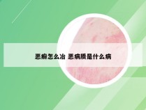 恶癣怎么冶 恶病质是什么病