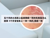 五个月的小孩身上起就跟癣一样的东西是怎么回事 5个月宝宝身上一块一块的,像癣一样