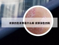 皮肤凹色素黄是什么癣 皮肤深色凹陷