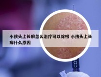 小孩头上长癣怎么治疗可以除根 小孩头上长癣什么原因