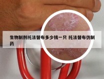 生物制剂托法替布多少钱一只 托法替布仿制药