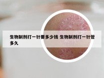 生物制剂打一针要多少钱 生物制剂打一针管多久