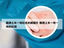 胳膊上长一块红色的癣图片 胳膊上长一块一块的红斑