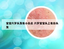 宝宝六岁头发有小白点 六岁宝宝头上有白头发