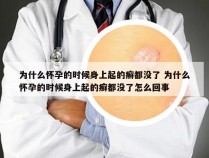 为什么怀孕的时候身上起的癣都没了 为什么怀孕的时候身上起的癣都没了怎么回事