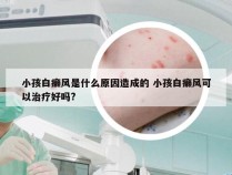 小孩白癞风是什么原因造成的 小孩白癞风可以治疗好吗?