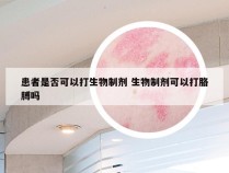 患者是否可以打生物制剂 生物制剂可以打胳膊吗