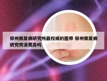 郑州银屑病研究所最权威的医师 郑州银屑病研究院消费高吗