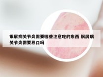 银屑病关节炎需要哪些注意吃的东西 银屑病关节炎需要忌口吗