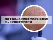 成都市第二人民皮肤病医院怎么样 成都市第二人民皮肤科医院门诊时间