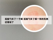 后脑勺长了一个癣 后脑勺长了癣一样的东西还蔓延了