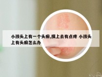 小孩头上有一个头癣,摸上去有点疼 小孩头上有头癣怎么办