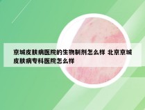 京城皮肤病医院的生物制剂怎么样 北京京城皮肤病专科医院怎么样