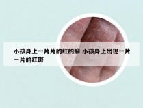 小孩身上一片片的红的癣 小孩身上出现一片一片的红斑