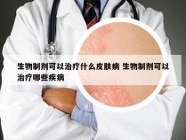 生物制剂可以治疗什么皮肤病 生物制剂可以治疗哪些疾病