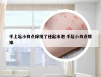 手上起小白点痒挠了还起水泡 手起小白点瘙痒