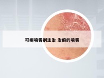 可癣喷雾剂主治 治癣的喷雾