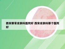 西安那家皮肤科医院好 西安皮肤科那个医院好