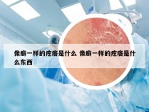 像癣一样的疙瘩是什么 像癣一样的疙瘩是什么东西