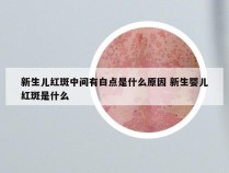 新生儿红斑中间有白点是什么原因 新生婴儿红斑是什么