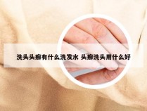 洗头头癣有什么洗发水 头癣洗头用什么好