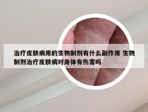 治疗皮肤病用的生物制剂有什么副作用 生物制剂治疗皮肤病对身体有伤害吗