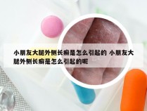 小朋友大腿外侧长癣是怎么引起的 小朋友大腿外侧长癣是怎么引起的呢