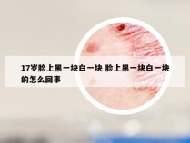 17岁脸上黑一块白一块 脸上黑一块白一块的怎么回事