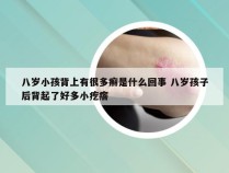 八岁小孩背上有很多癣是什么回事 八岁孩子后背起了好多小疙瘩