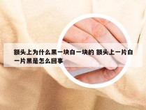 额头上为什么黑一块白一块的 额头上一片白一片黑是怎么回事