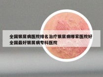 全国银屑病医院排名治疗银屑病哪家医院好 全国最好银屑病专科医院