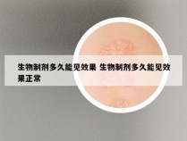 生物制剂多久能见效果 生物制剂多久能见效果正常