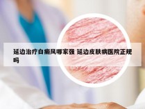 延边治疗白癜风哪家强 延边皮肤病医院正规吗