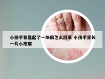 小孩手背是起了一块癣怎么回事 小孩手背长一片小疙瘩