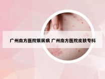 广州南方医院银屑病 广州南方医院皮肤专科