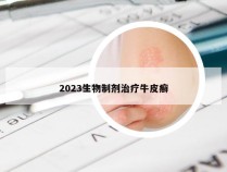 2023生物制剂治疗牛皮癣