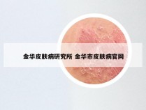 金华皮肤病研究所 金华市皮肤病官网