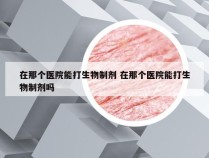 在那个医院能打生物制剂 在那个医院能打生物制剂吗