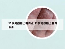 11岁男孩脸上有白点 11岁男孩脸上有白点点