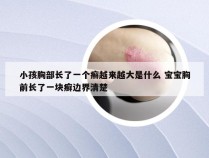 小孩胸部长了一个癣越来越大是什么 宝宝胸前长了一块癣边界清楚