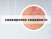 长春银屑病医学研究院 长春银屑病院哪个好