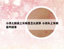 小孩儿脑袋上长癣是怎么回事 小孩头上有癣是咋回事