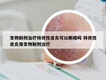 生物制剂治疗特异性皮炎可以断根吗 特异性皮炎用生物制剂治疗