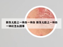 新生儿脸上一块白一块白 新生儿脸上一块白一块红怎么回事