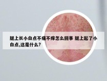 腿上长小白点不痛不痒怎么回事 腿上起了小白点,这是什么?