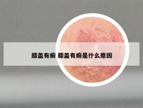 膝盖有癣 膝盖有癣是什么原因